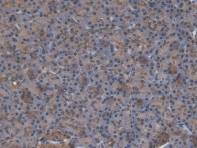 Polyclonal Antibody to Aldehyde Dehydrogenase 3 Family, Member A1 (ALDH3A1)