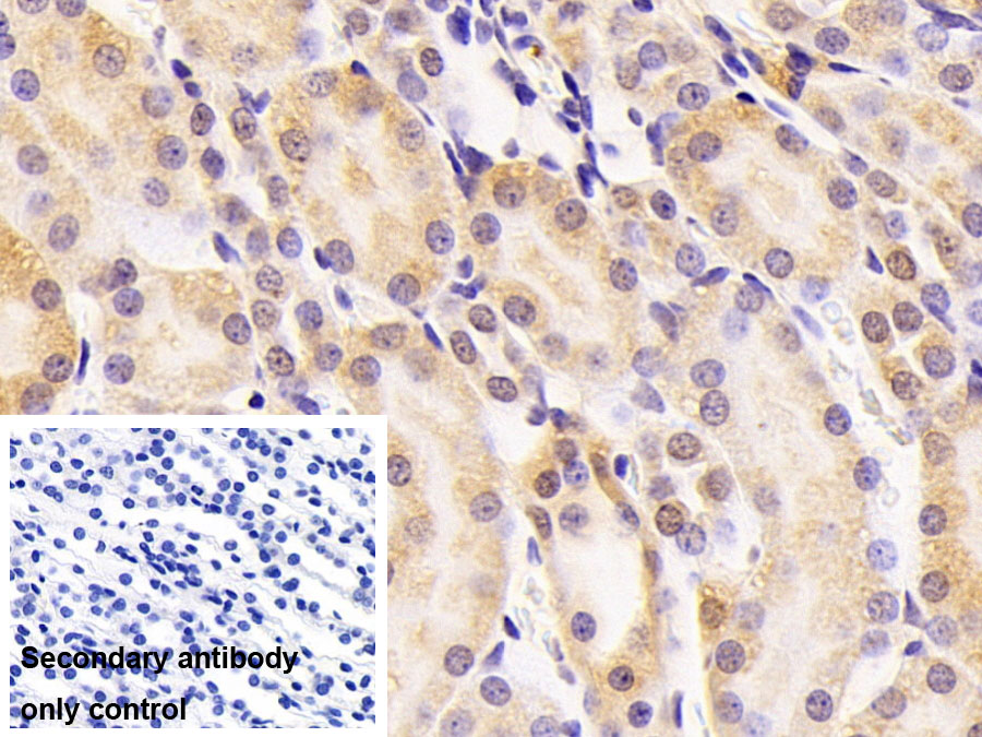 Polyclonal Antibody to Histone Deacetylase 4 (HDAC4)