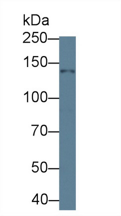 Polyclonal Antibody to Histone Deacetylase 4 (HDAC4)