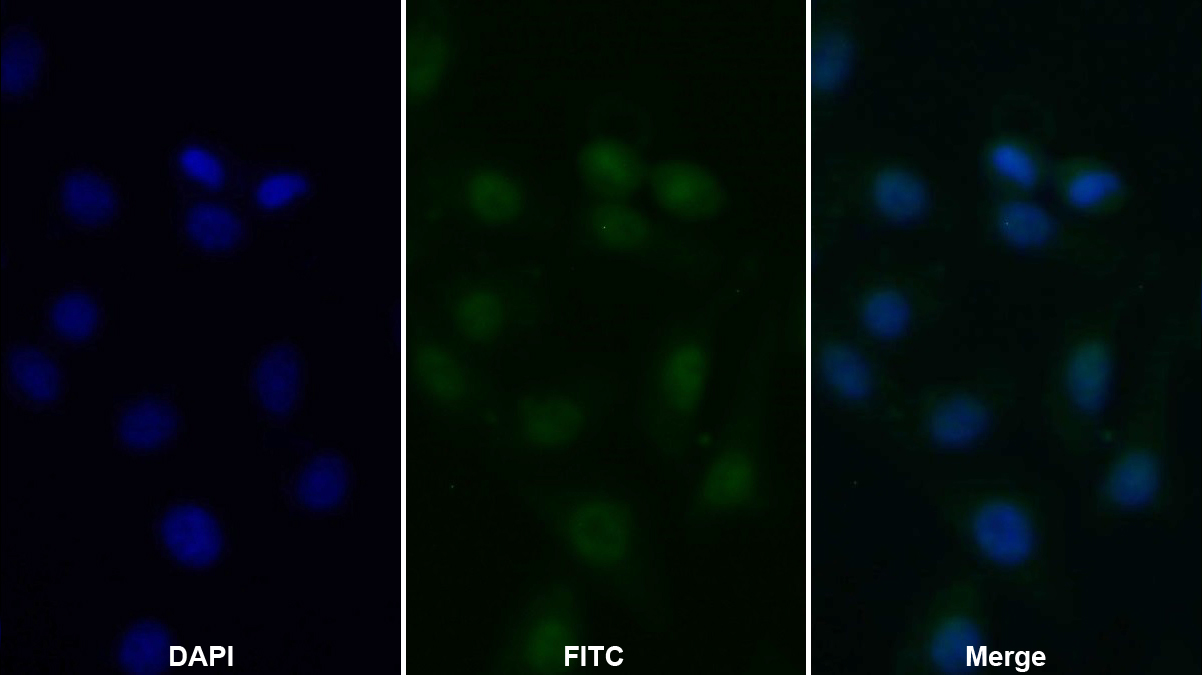 Polyclonal Antibody to Histone Deacetylase 6 (HDAC6)