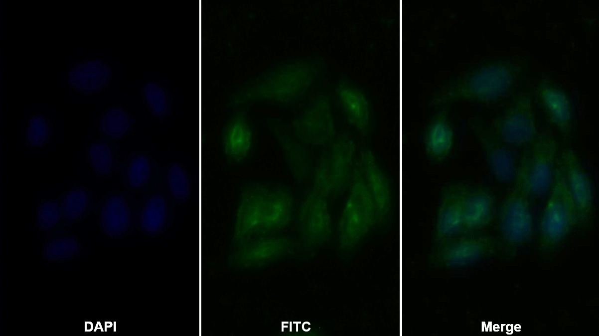 Polyclonal Antibody to Histone Deacetylase 6 (HDAC6)