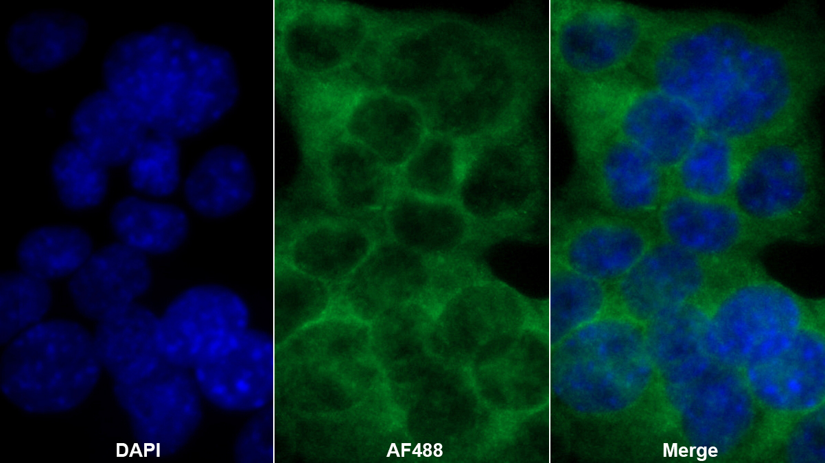 Polyclonal Antibody to Sirtuin 1 (SIRT1)