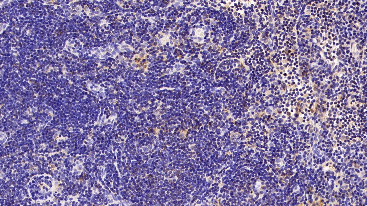 Polyclonal Antibody to Sirtuin 3 (SIRT3)