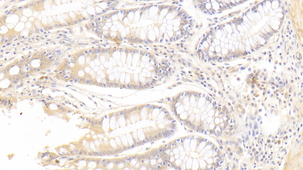 Polyclonal Antibody to Filamin B Beta (FLNb)