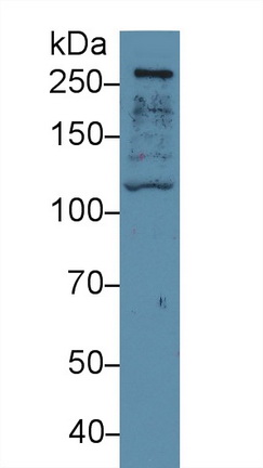 Polyclonal Antibody to Filamin B Beta (FLNb)