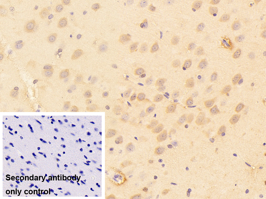 Polyclonal Antibody to Ribosomal Protein, Large, P0 (RPLP0)