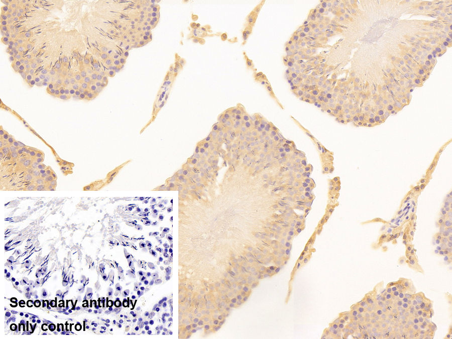 Polyclonal Antibody to Ribosomal Protein, Large, P0 (RPLP0)