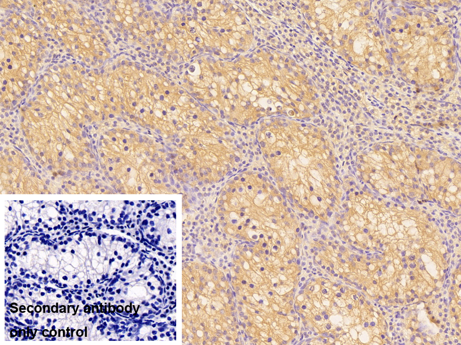 Polyclonal Antibody to Eukaryotic Translation Initiation Factor 3M (EIF3M)