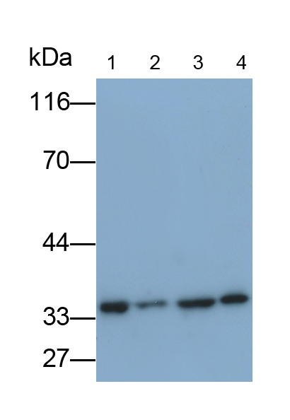 Polyclonal Antibody to Eukaryotic Translation Elongation Factor 1 Beta 2 (EEF1b2)