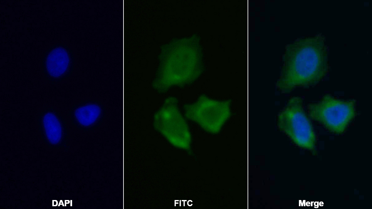Polyclonal Antibody to G Protein Alpha 11 (GNa11)