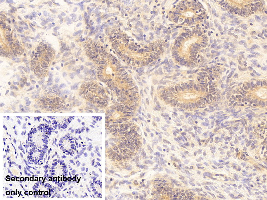 Polyclonal Antibody to Wilms Tumor Protein (WT1)