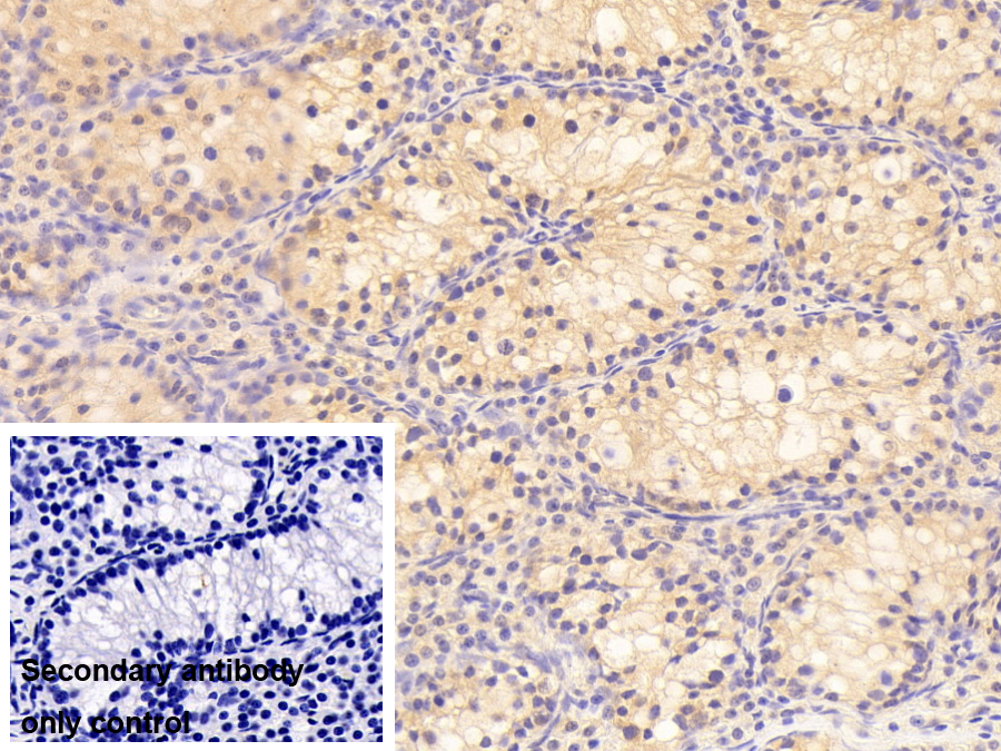 Polyclonal Antibody to Wilms Tumor Protein (WT1)