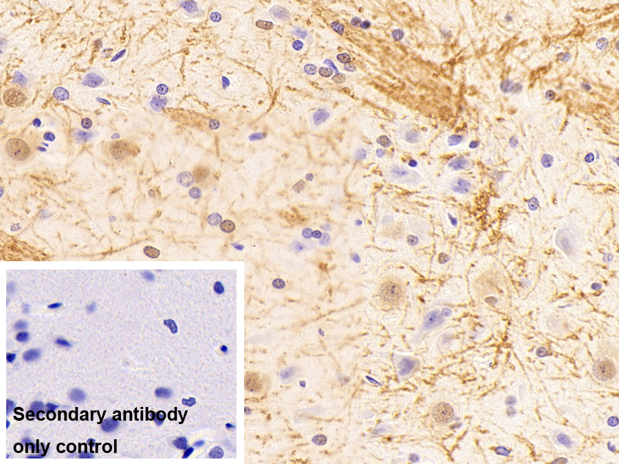 Polyclonal Antibody to Heterogeneous Nuclear Ribonucleoprotein K (HNRPK)