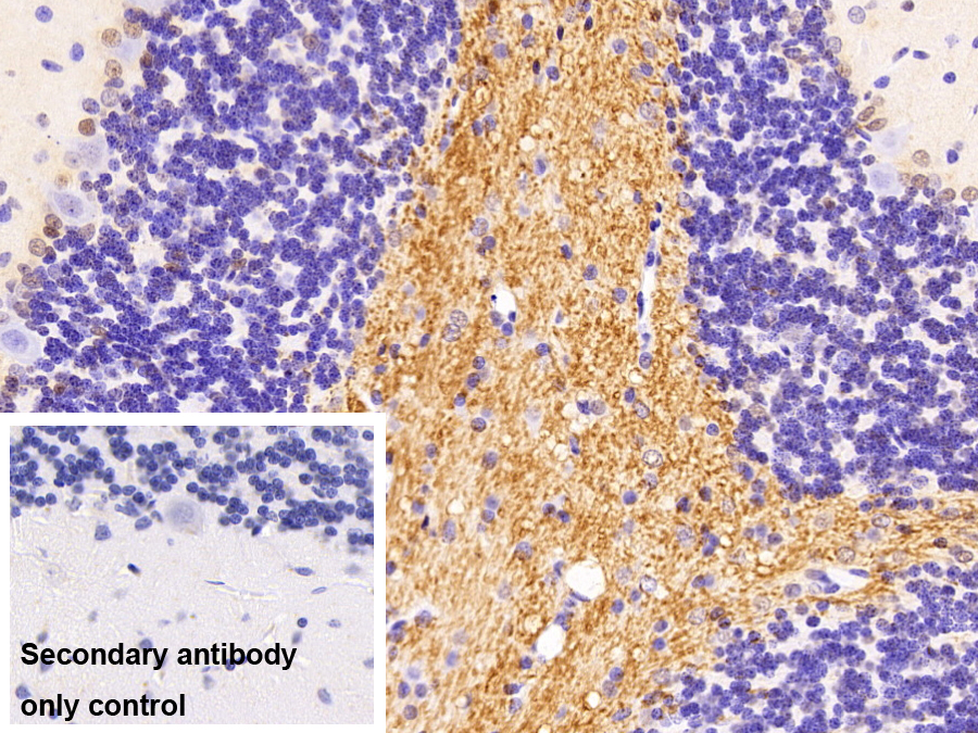 Polyclonal Antibody to Heterogeneous Nuclear Ribonucleoprotein K (HNRPK)