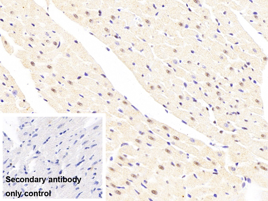 Polyclonal Antibody to Heterogeneous Nuclear Ribonucleoprotein K (HNRPK)