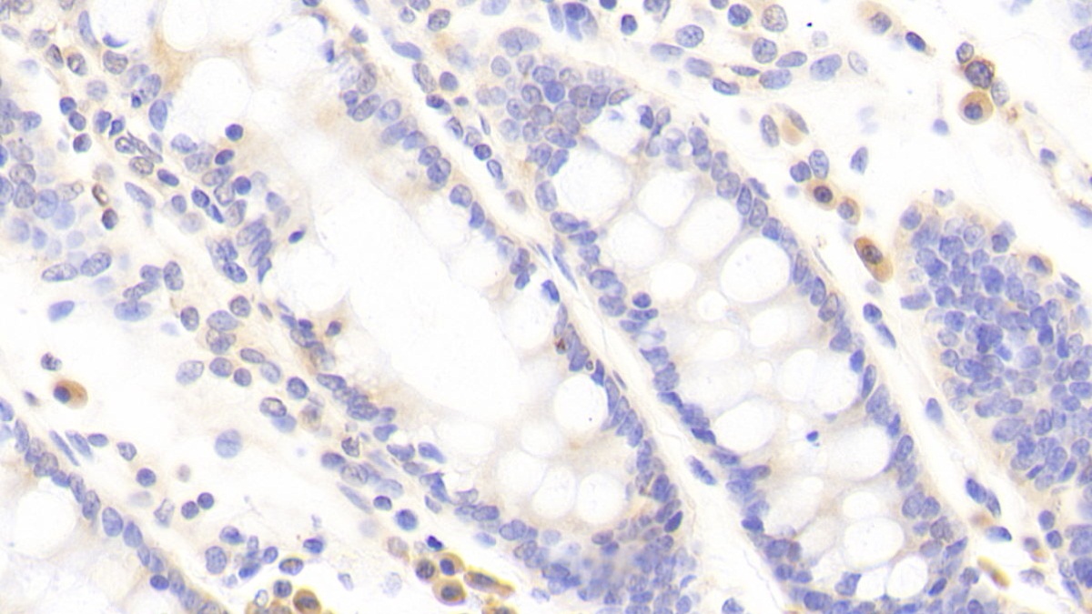 Polyclonal Antibody to Tight Junction Protein 2 (TJP2)