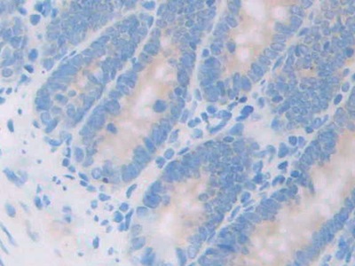 Polyclonal Antibody to 17-Beta-Hydroxysteroid Dehydrogenase Type 12 (HSD17b12)