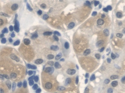 Polyclonal Antibody to Anthrax Toxin Receptor 2 (ANTXR2)