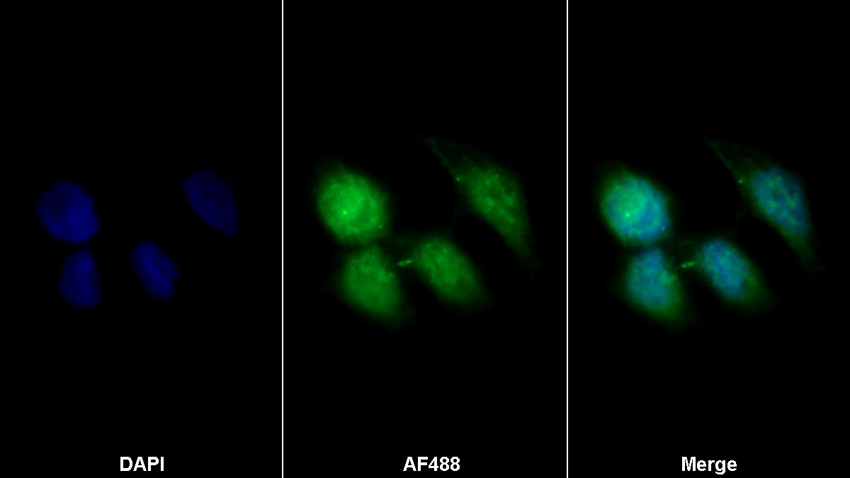 Polyclonal Antibody to Tight Junction Protein 3 (TJP3)