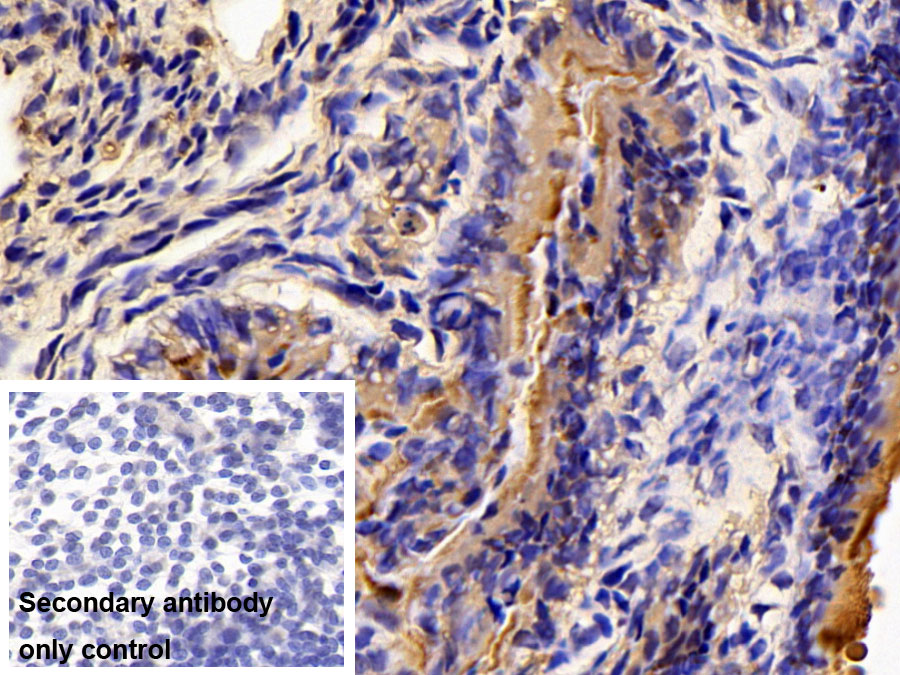 Polyclonal Antibody to Tight Junction Protein 3 (TJP3)