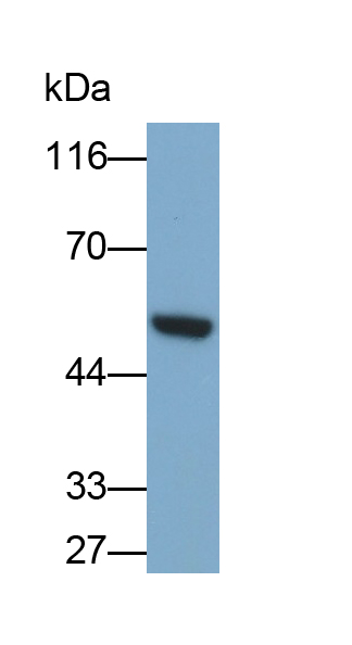 Polyclonal Antibody to Carboxypeptidase N1 (CPN1)