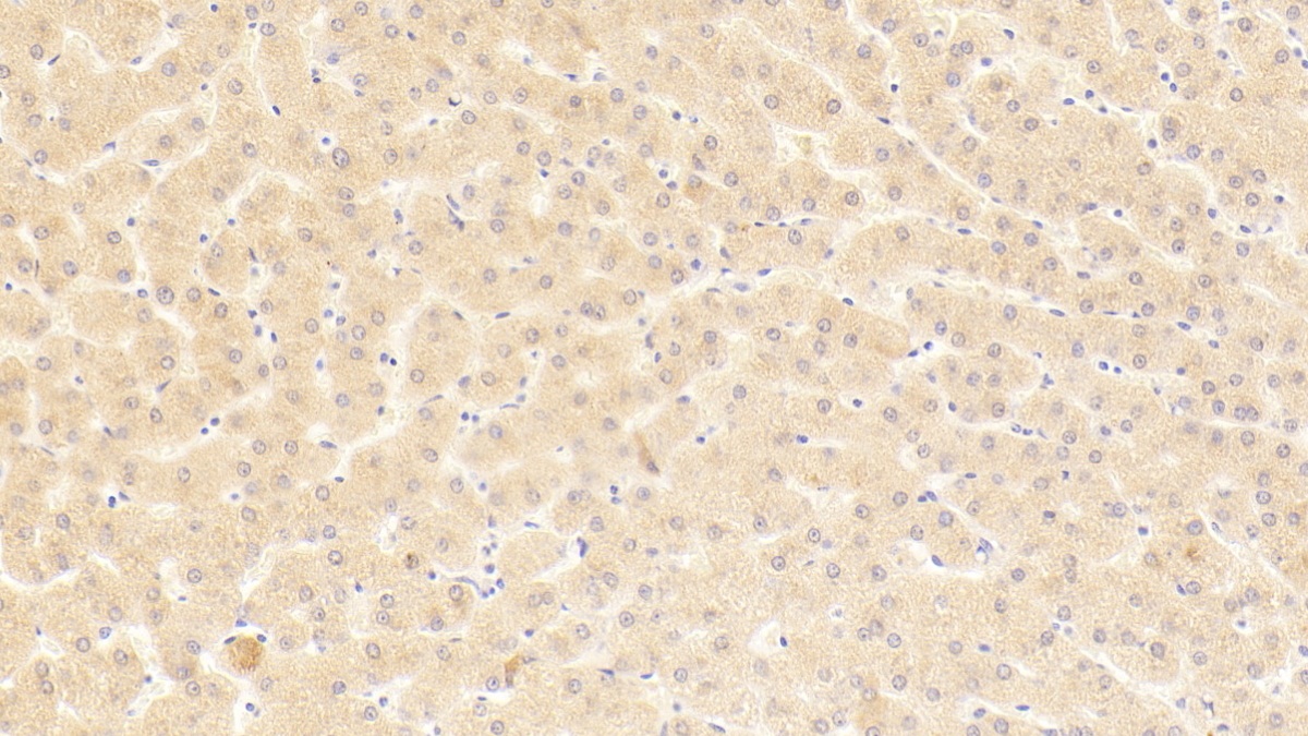 Polyclonal Antibody to Carboxypeptidase N2 (CPN2)