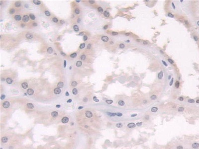 Polyclonal Antibody to Cellular Retinoic Acid Binding Protein 2 (CRABP2)