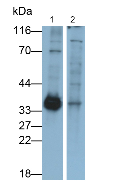Polyclonal Antibody to Crystallin Lambda 1 (CRYl1)