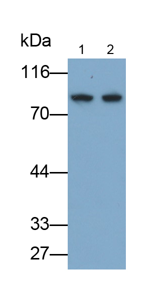 Polyclonal Antibody to Carnitine Palmitoyltransferase 1A, Liver (CPT1A)