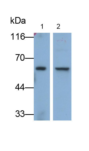 Polyclonal Antibody to Fatty Acid Desaturase 2 (FADS2)