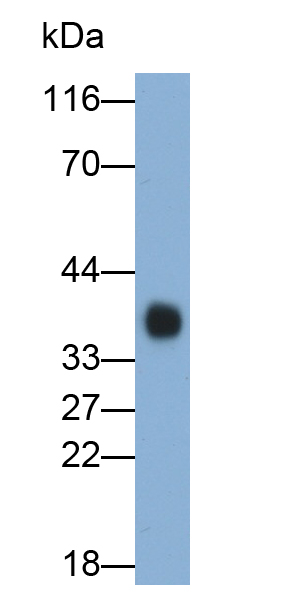 Polyclonal Antibody to Folate Receptor 1, Adult (FOLR1)