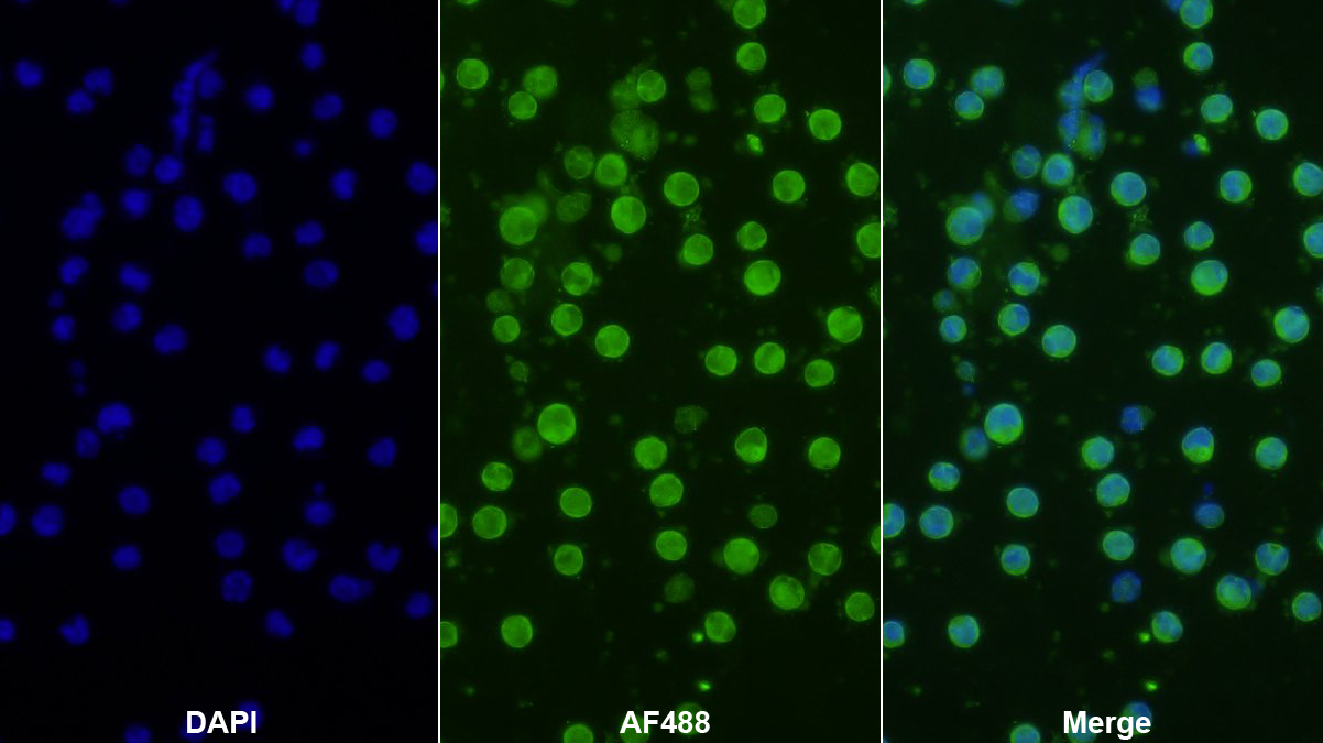 Polyclonal Antibody to Centaurin Alpha 2 (CENTa2)