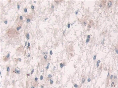 Polyclonal Antibody to Growth Factor Receptor Bound Protein 10 (Grb10)