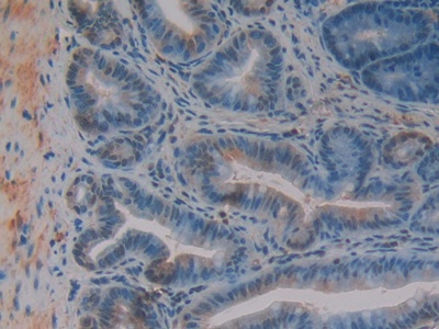 Polyclonal Antibody to Growth Factor Receptor Bound Protein 7 (Grb7)