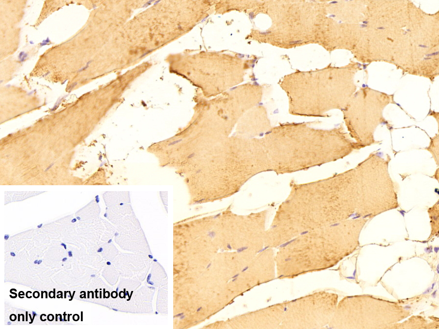Polyclonal Antibody to Calsequestrin 2 (CASQ2)