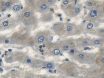 Polyclonal Antibody to Uncoupling Protein 1, Mitochondrial (UCP1)