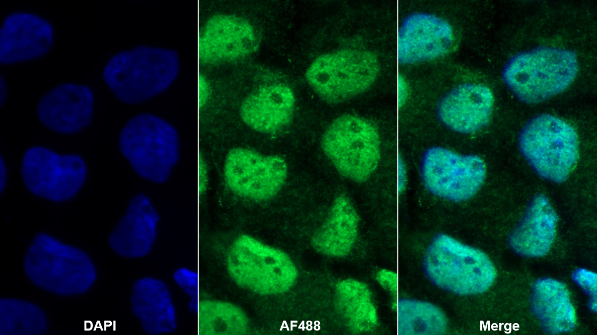 Polyclonal Antibody to Metastasis Associated Protein 2 (MTA2)
