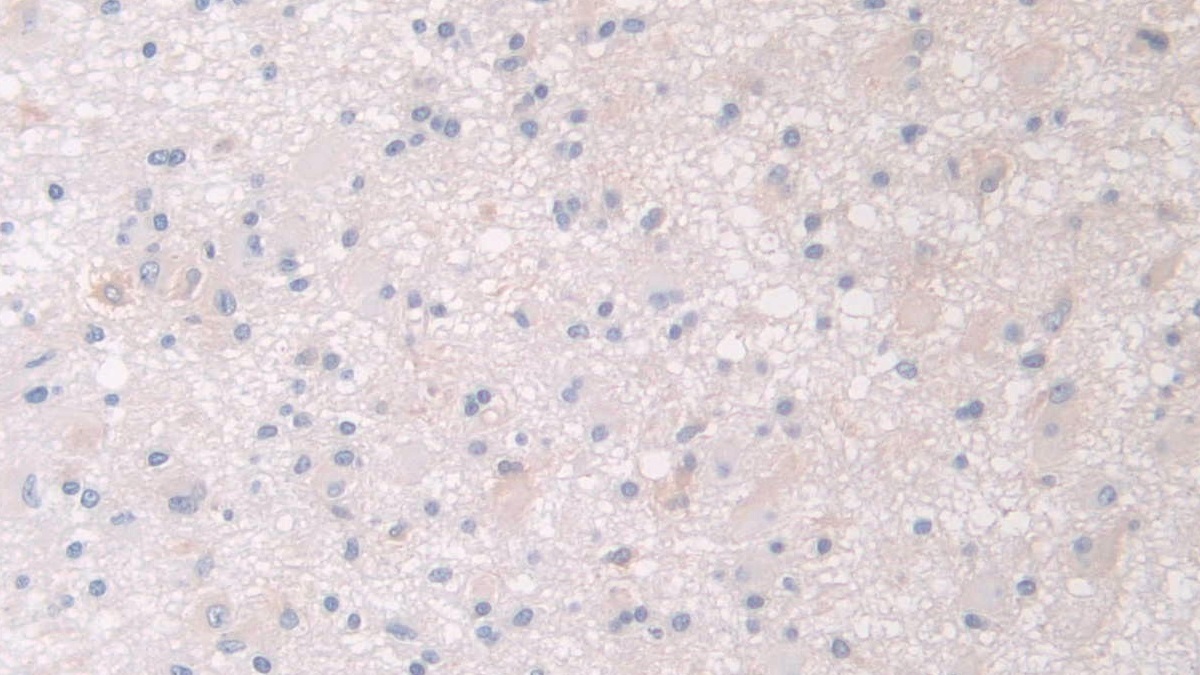 Polyclonal Antibody to Pantothenate Kinase 4 (PANK4)