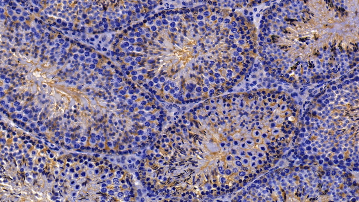 Polyclonal Antibody to Peroxiredoxin 2 (PRDX2)