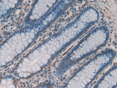 Polyclonal Antibody to Phosphatase And Tensin Homolog (PTEN)