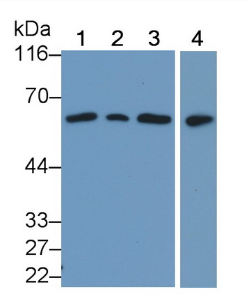 Polyclonal Antibody to Phosphatase And Tensin Homolog (PTEN)