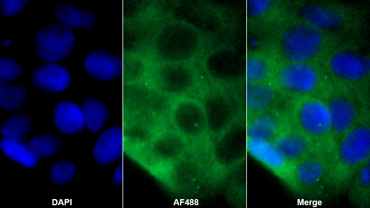Polyclonal Antibody to S-Phase Kinase Associated Protein 1 (SKP1)