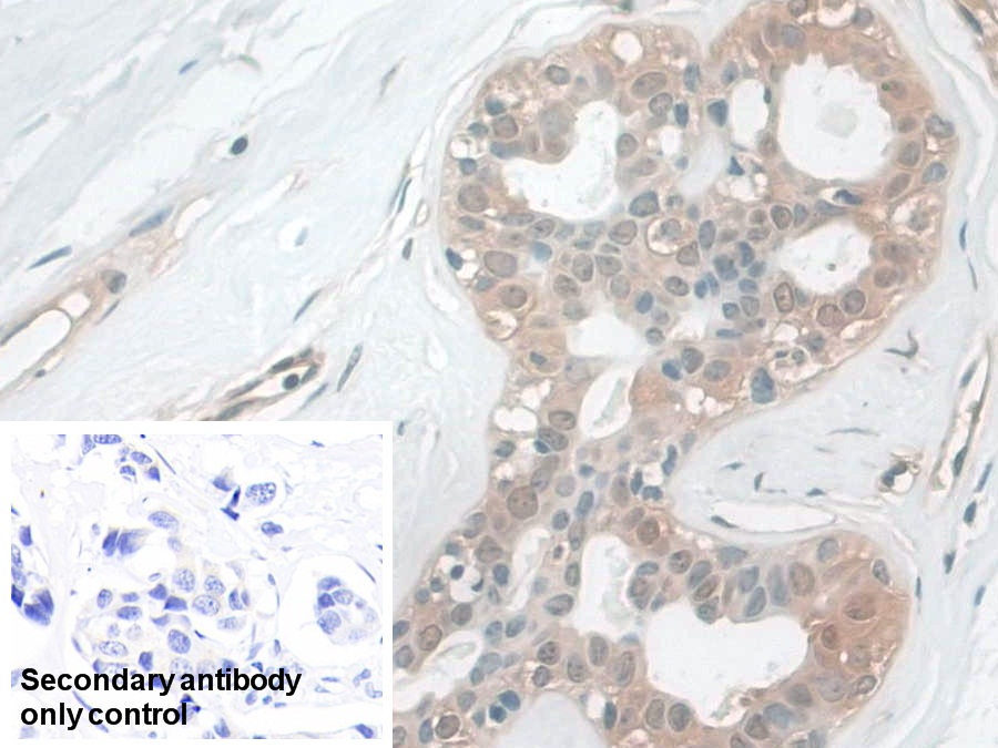 Polyclonal Antibody to Calmodulin Like Protein 5 (CALML5)