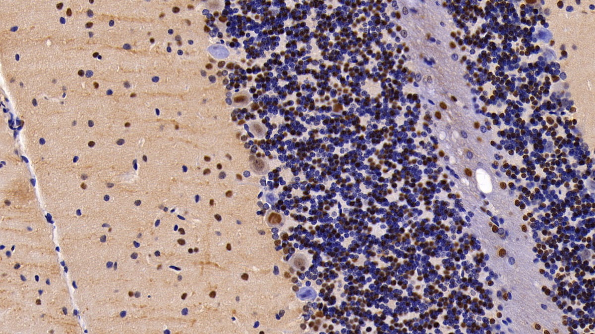 Polyclonal Antibody to Ubiquitin Like Modifier Activating Enzyme 2 (UBA2)