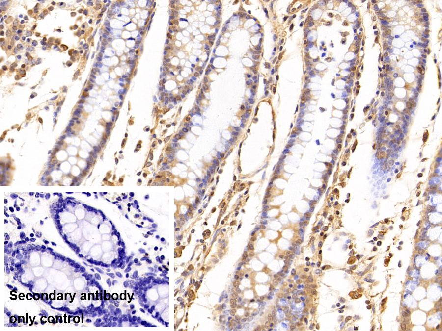 Polyclonal Antibody to Proteasome Subunit Beta Type 3 (PSMb3)