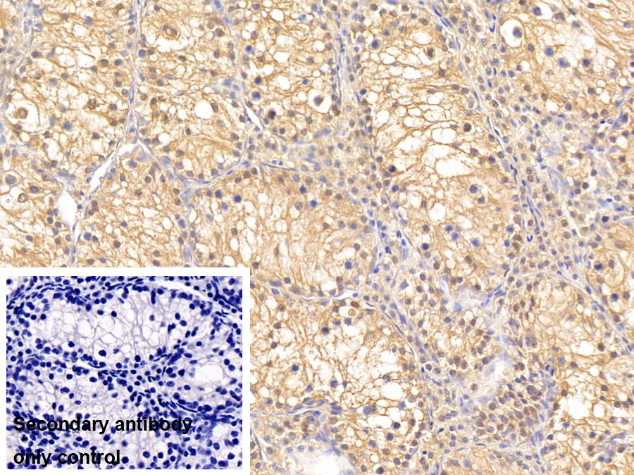 Polyclonal Antibody to Proteasome Subunit Beta Type 3 (PSMb3)