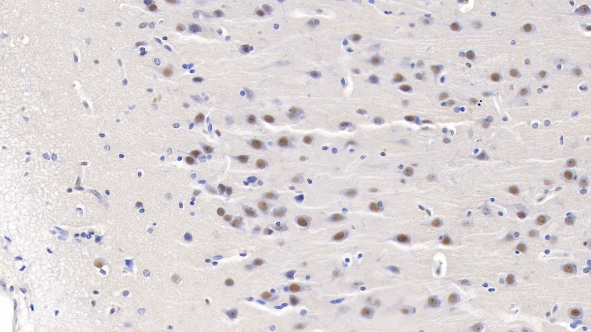 Polyclonal Antibody to Proteasome Activator Subunit 3 (PSME3)