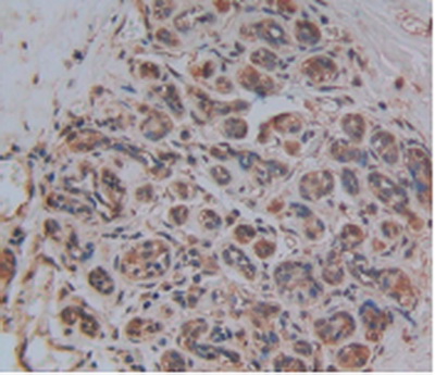 Polyclonal Antibody to Corin (CRN)