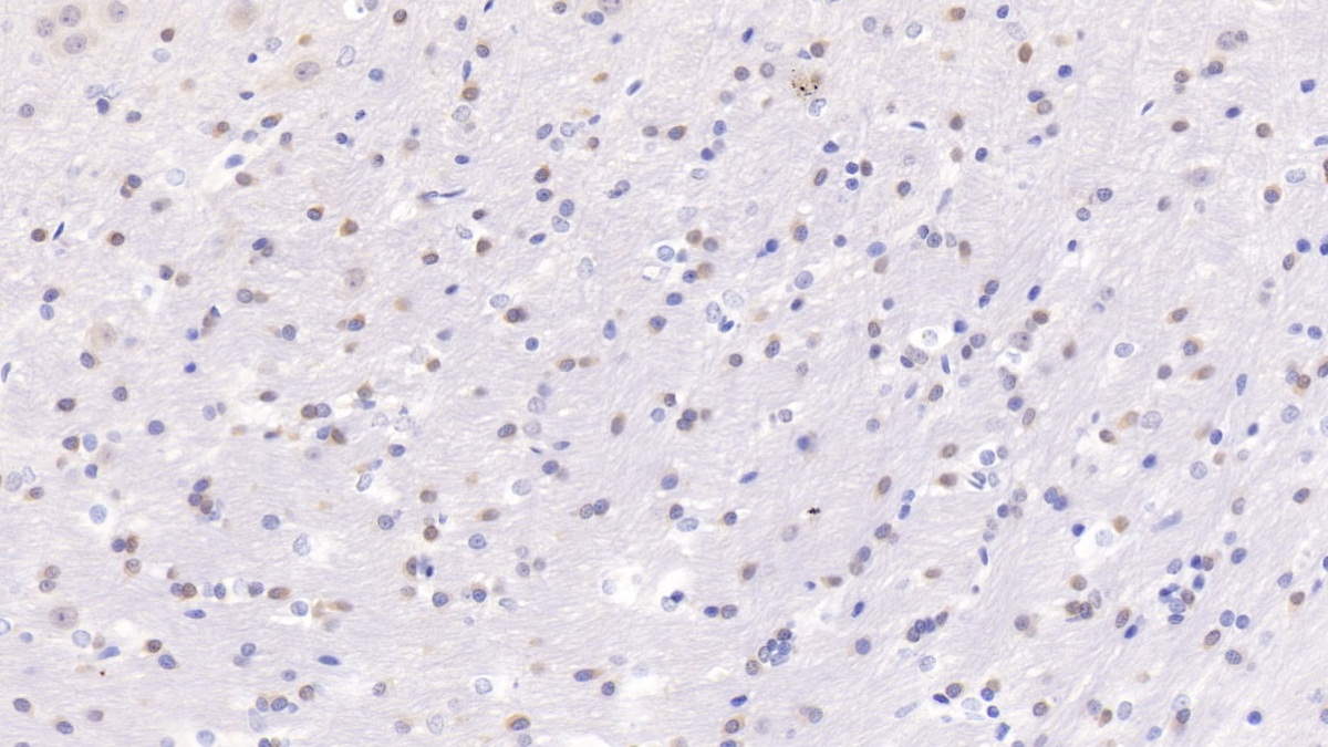 Polyclonal Antibody to Channel Activating Protease 1 (CAP1)