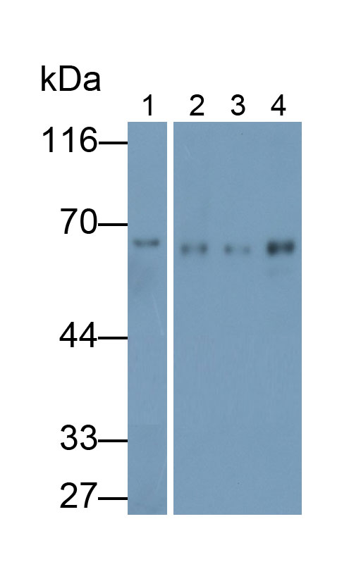 Polyclonal Antibody to Acetoacetyl Coenzyme A Synthetase (AACS)